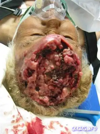 Увеличить картинку