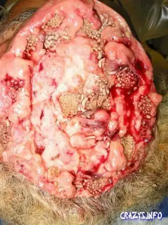 Увеличить картинку