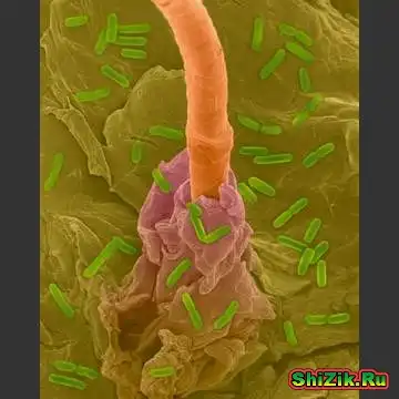 Под микроскопом ;)