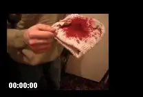 Максу было больно