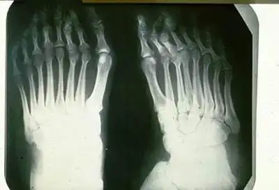 Шоссе смерти в Ираке: 15 лет жертвы радиации рожают уродов.