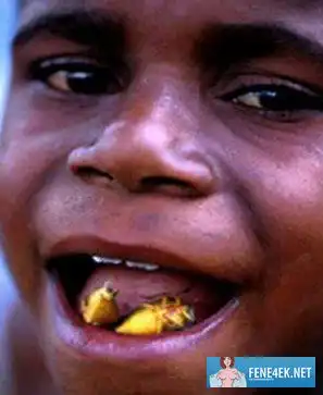 Хорошая диета, не очень жирная пища.