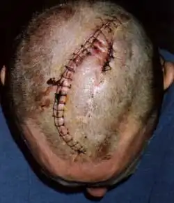 АнтиФа как она есть...