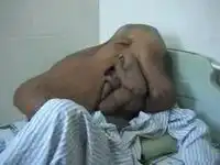 Жестокая болезнь