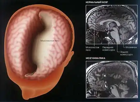 Феноменальный мозг