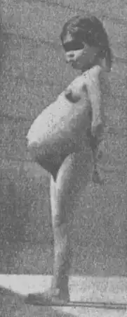 Самая молодая мама в мире. Шок.