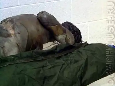 Частично разлагающаяся женщина