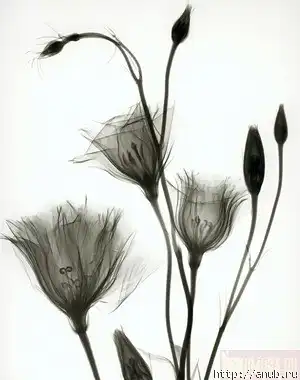 "Рентгеновская" фотожаба