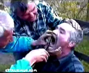 Дантисты. Жесть