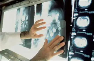 Онкологию следует лечить, а не бояться {Рак}