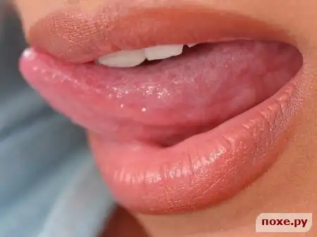 Губастый пост