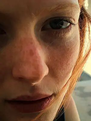 Милые веснушки (42 фото)