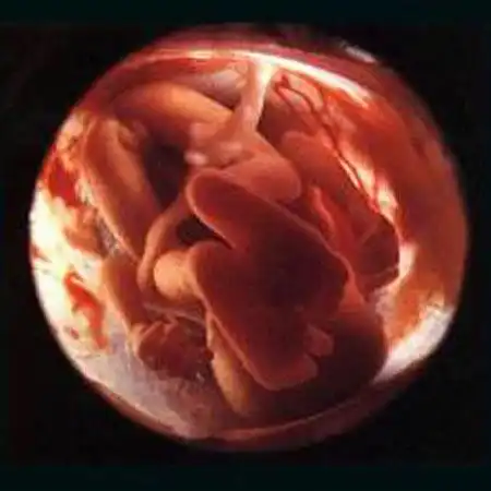 Как живет ребенок до своего появления на свет