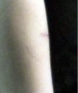 Шок! Вика Дайнеко изуродовалась!