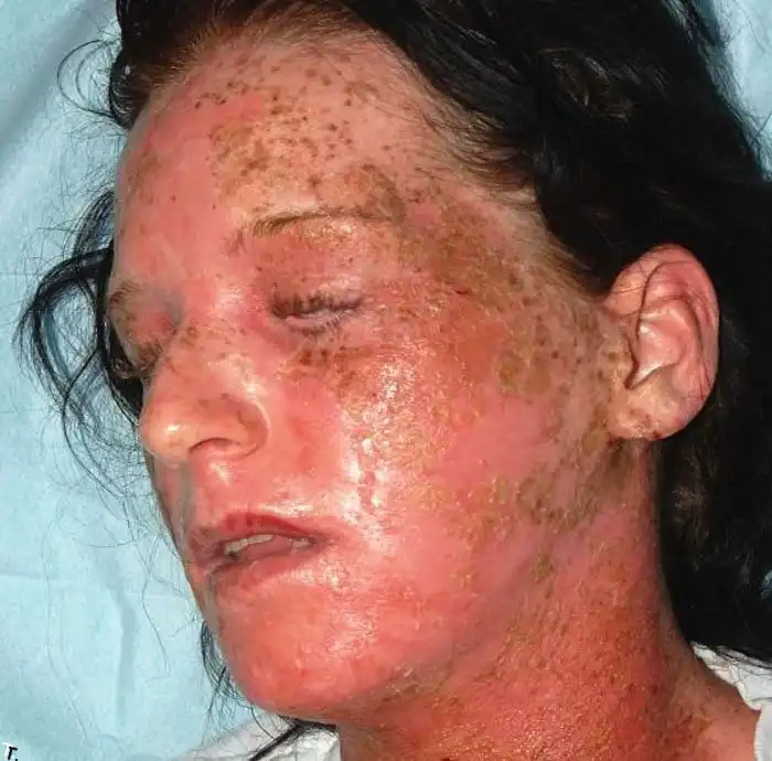 Девушка купила дешевую краску для волос...