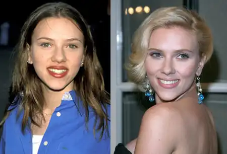 9 лучших исправленных носов