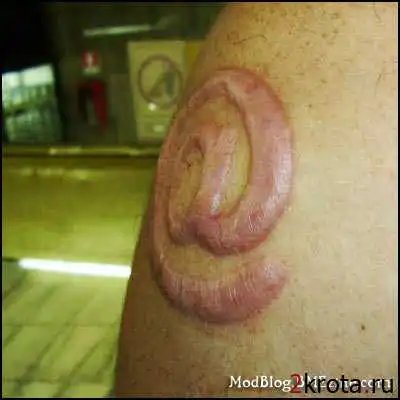 Шрамирование