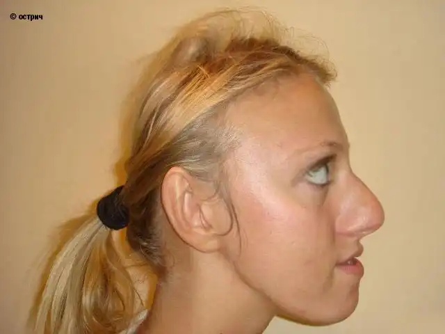 Чудеса трансформации Ксении Собчак