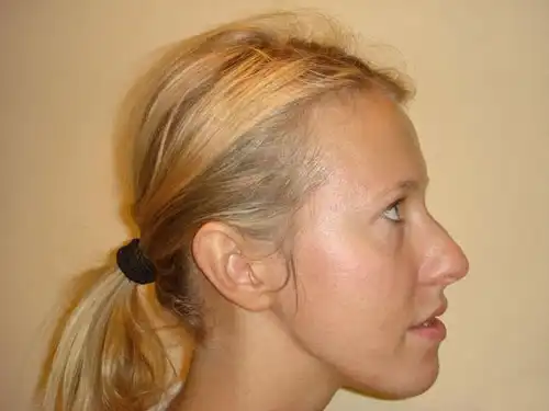 Чудеса трансформации Ксении Собчак