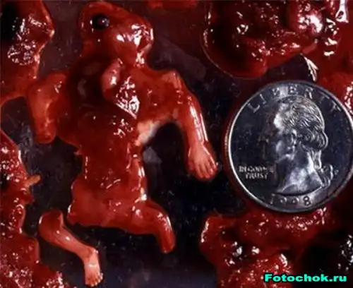 Могли бы жить...