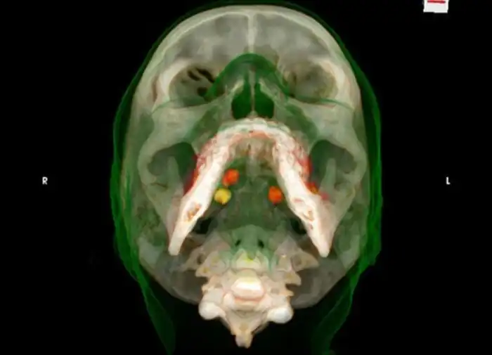 Как возят наркотики внутри себя