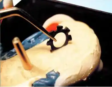 Как делают зубы (интересно)