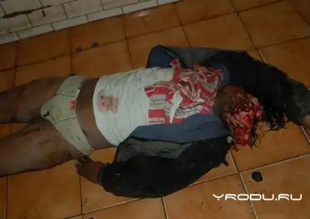 Мужику разнесло бошку