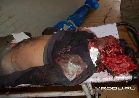 Мужику разнесло бошку