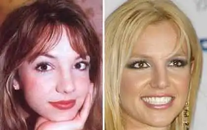 Знаменитости, рискнувшие лечь под нож хирурга (удачные и НЕ очень эксперименты со внешностью)