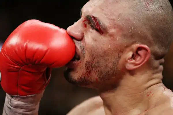 Бои без правил - жестокий спорт