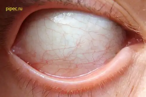 Как вам такая жесть? Еще хлеще чем обычно "аккуратнее"