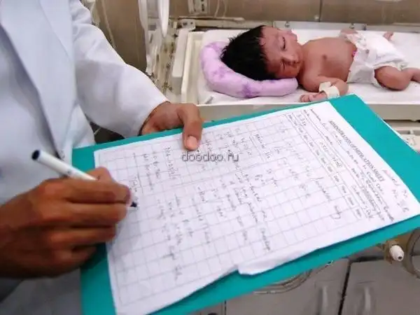 Ребенок с двумя лицами