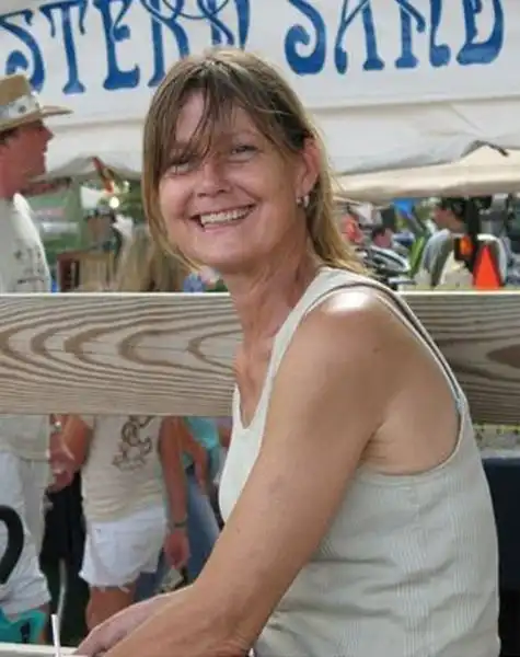 У жертвы шимпанзе новое лицо (3 фото)