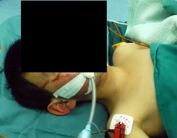 С ножницами в голове (4 фото)