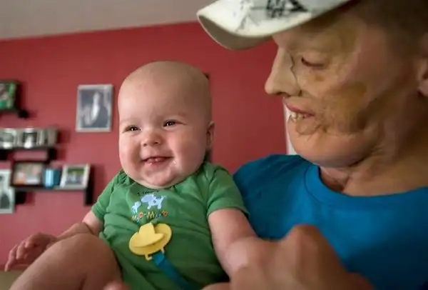 Человек, спасший другому жизнь, пострадал сам