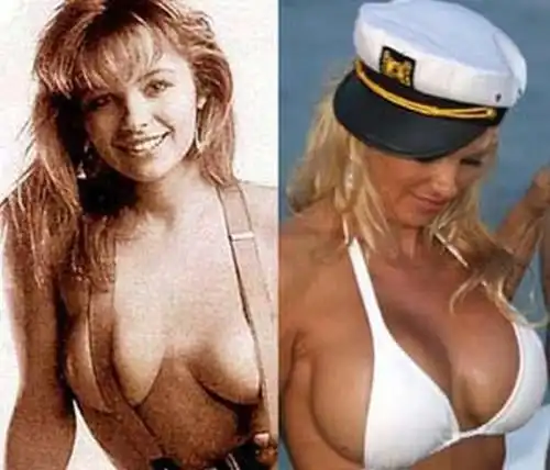 10 звезд которые увеличили сиськи