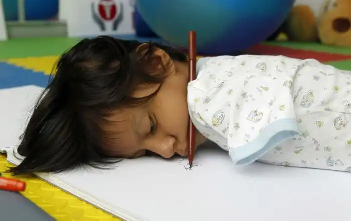 Неунывающая девочка - инвалид из Перу