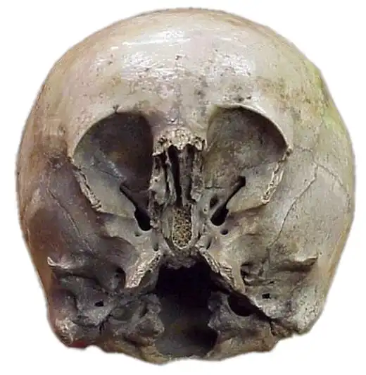 Итоги исследования черепа "Звездного ребенка"