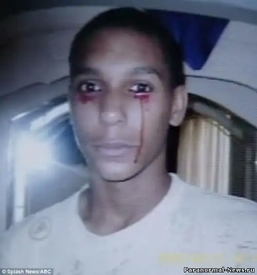 Американский подросток плачет кровью.