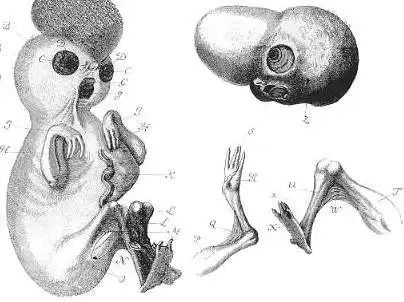 Женщина родила пришельца