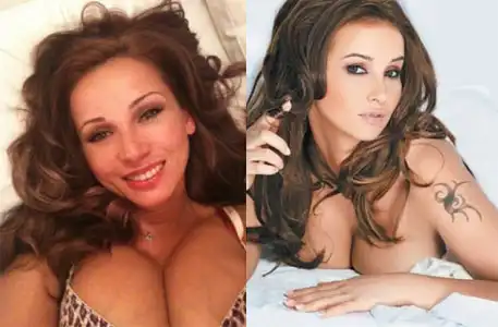 Пластические операции звёзд