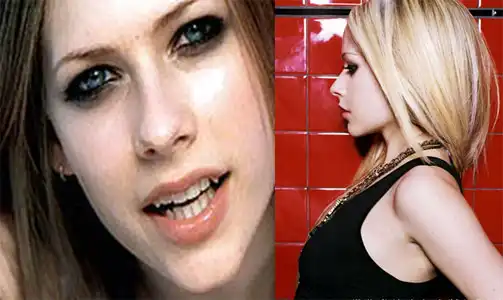 Пластические операции звёзд