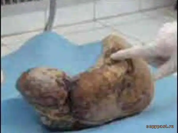 На свет появился уникальный каменный ребенок