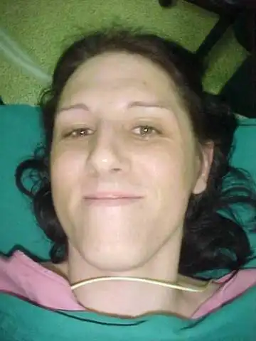 операция по перемене пола с мужского в женский!