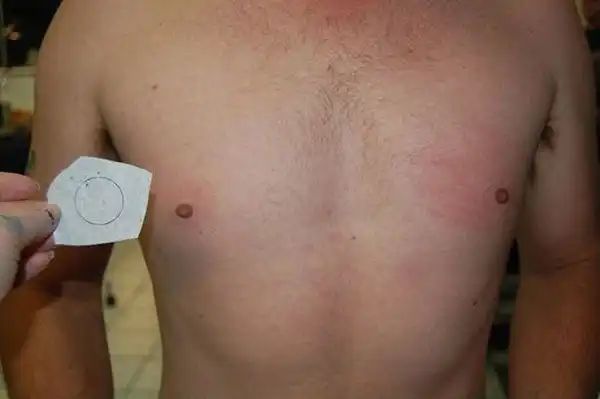 Что делать мужику, если у него соски маленького размера?