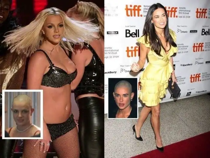 Лысые и прекрасные