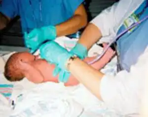 Шок: роды британки продолжались... 20 дней!