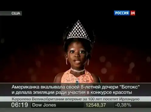 Ботокс для 8-летней девочки 2