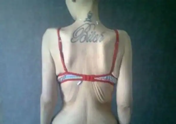 Из толстушки в анорексичку (Мини пост)