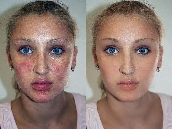 Before - After. Made by Photoshop.